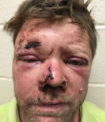 Slippery Rock Man Sues New Castle Police Citing Excessive Force